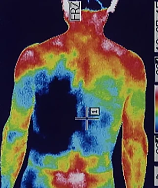 Thermography test for checking autonomic nervous system abnormalities